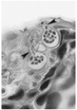 <strong>  The above figure represents ____, a group of parasitic fungi that are killing amphibians around the world.</strong> A) Chytrids B) Ascomycetes C) Basidiomycetes D) Glomeromycetes E) Zygomycetes <div style=padding-top: 35px> 