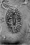 <strong> Which of the following statements is true?</strong> A) Mosses have xylem B) Mosses have lignin. C) Mosses have true stems. D) Mosses have rhizoids. E) Mosses have independent sporophytes.