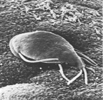 <strong> To which of the following groups does the organism in the above figure belong?</strong> A) diplomonads, parabasalids, trypanosomes, and euglenoids B) ciliates, dinoflagellates, and apicomplexans C) water molds, diatoms, and brown algae D) chlorophyte and charophyte algae E) amoebas and slime molds