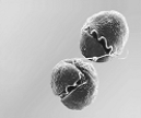 <strong> The above organism is responsible for fish kills and belongs to which of the following groups?</strong> A) chrysophytes B) dinoflagellates C) flagellated protozoans D) ciliates E) oomycotes