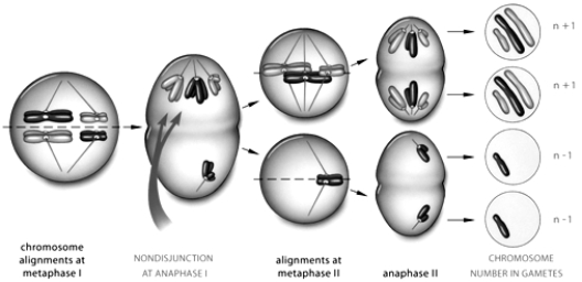 <strong> The above figure represents which of the following:</strong> A) a male with trisomy 21 B) a female with trisomy 21 C) a result caused by the use of colchicine D) a gorilla globin gene spread E) none of these