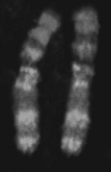 <strong> The above figure represents</strong> A) individual genes from an asexual worm. B) maternal chromosomes that are identical. C) paternal chromosomes that are identical. D) both maternal and paternal chromosomes. E) none of these.
