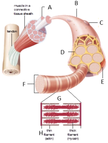  -In the accompanying figure, the structure labeled H is a ____.