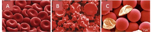 In the following pictures of red blood cells emerged in three different solutions, identify which picture corresponds to each of the following solutions. a. A b. B c. C -hypotonic