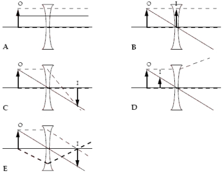 <strong>Which ray diagram is correct? The three rays in each diagram are distinguished by different types of lines.Hint: Check the behaviour of each ray as it interacts with the lens. </strong> A)A B)B C)C D)D E)E