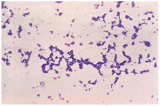 <strong>Review the Gram stain image provided of a positive blood culture bottle. It should be </strong> A) pleomorphic gram-positive coccobacilli. B) gram-positive cocci in pairs and chains. C) gram-positive cocci in clusters. D) palisading gram-negative cocci.