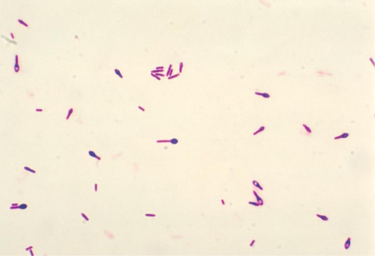 <strong>Review the image of a leg wound culture provided. The organisms appear as gram-variable rods. What Gram stain reaction should be reported for this organism? Source: CDC and Dr. George Lombard</strong> A) Gram negative B) Gram positive C) Gram variable D) Gram positive and gram negative