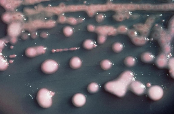 <strong>Based on the colonies observed in the image provided, you can deduce the organism 1) is a gram-negative rod. 2) is a gram-positive coccus. 3) produces a capsule. 4) produces a pigment.</strong> A) 1, 3, and 4 B) 2, 3, and 4 C) 2 and 4 D) 1 and 3