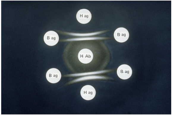 <strong>The image provided is an example of a/an _________________ test. </strong> A) agglutination B) precipitation C) complement fixation D) immunoelectrophoresis