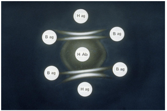 <strong>Using the image provided, interpret the results depicted. Key to image: H Ab = Histoplasma capsulatum antibodies, H Ag = extract of Histoplasma capsulatum, B Ag = extract of Blastomyces dermatitidis</strong> A) The B. dermatitidis extract shows the presence of an antigen that cross reacts with the antibodies present. B) The antigens present in the B) dermatitidis and H. capsulatum extracts are partially cross reactive. C) The H. capsulatum extract shows a non-identity reaction with the antibodies D) The H. capsulatum extract shows the presence of two antigens that cross react with the antibodies present.