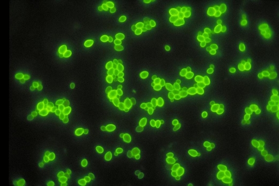 <strong>Review the image provided and interpret the direct fluorescent antibody reaction observed. Source: CDC, Maxine Jalbert, Dr. Leo Kaufman</strong> A) Positive for yeast B) Negative for yeast C) Positive for gram-positive cocci D) Negative for gram-positive cocci