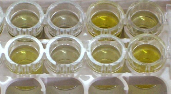 <strong>Given the following image, determine the optimal means to measure the amount of antibody present in serum. Source: Microrao</strong> A) Visually B) With the use of a spectrophotometer C) By flow cytometry D) Using a nephelometer