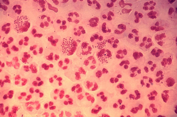<strong>A 17-year-old male develops septic arthritis in his left knee. His physician aspirates synovial fluid and sends it to the microbiology laboratory. A direct Gram stain of the fluid is demonstrated in the image provided. Source: CDC/Joe Millar Which of the following tests is necessary for definitive identification of this Organism?</strong> A) coagulase test. B) streptococcal serotyping. C) rapid carbohydrate fermentation test. D) spot indole test.