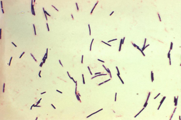 <strong>A 28-year-old male received a compound fracture of his right arm after a motorcycle accident. Three days after the arm has been set, purulent material is observed from under his bandages. An aerobic and anaerobic culture of the wound site is sent to the microbiology department. A direct Gram stain of the wound is demonstrated in the image provided. Source: CDC and Don Stalons If the organism proved to be catalase negative, you observed the colony on</strong> A) sheep blood and reducible blood agars. B) sheep blood only. C) reducible blood agar only. D) sheep blood and phenylethyl alcohol agars.
