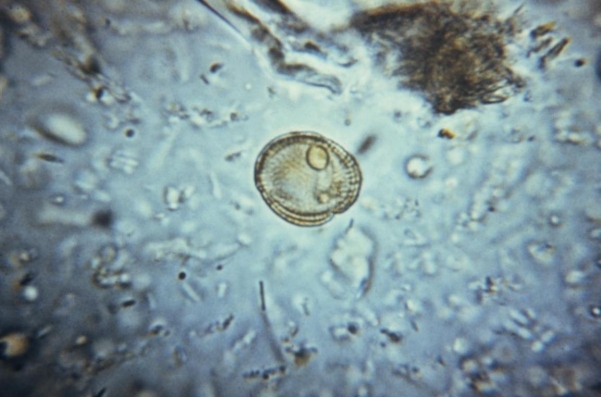 <strong>Review the image provided and identify it. Source: CDC</strong> A) Pollen granule B) Taenia spp. ova C) Plant cell D) Yeast cell