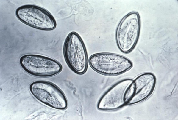 <strong>Review the image provided. Source: CDC What laboratory procedure was used to recover this organism?</strong> A) Vaspar swab prep of perianal region B) Wet prep of concentrated stool C) Trichrome stain of stool smear D) Wet prep of duodenal aspirate