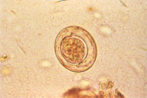 <strong>Review the image provided. Source: CDC In the life cycle of this organism, man serves as the ________________ host.</strong> A) intermediate B) definitive C) vector D) reservoir