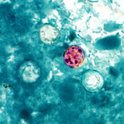 <strong>A 20-year-old male with leukemia presents with watery diarrhea of two weeks duration, nausea, weight loss, and anorexia. A stool sample is submitted for routine culture and ova and parasite examination. The routine culture is negative for Salmonella, Shigella, Campylobacter, Yersinia enterocolitica, and shiga-toxin producing E. coli. The concentrated wet mount exam and trichrome stained stool smear are negative. Additional testing revealed the organism as seen in the image provided. Source: CDC/DPDx - Melanie Moser Knowing the organism measures 9 \mu m, you would identify it as</strong> A) Cryptosporidium parvum. B) Cyclospora cayetanensis. C) microsporidia. D) yeast.