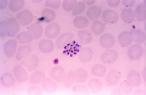 <strong>A 47-year-old male, who lives in Bangor, ME, returns from a trip to Southeast Asia. He visits his physician with fever, chills, headache, and malaise. His fevers seem to appear every 48 hours. A blood smear reveals the organism as seen on the image provided. Source: CDC/Steven Glenn, Laboratory Training & Consultation Division Given this information, you would report the organism as</strong> A) Plasmodium vivax. B) P. ovale. C) P. malariae. D) Babesia microti.