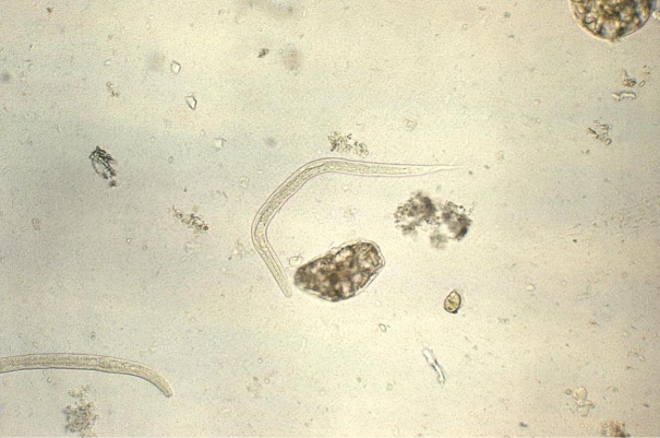 <strong>Prior to his kidney transplant, a 56-year-old male is tested for ova and parasites. One of three stools submitted demonstrates the organisms seen in the image provided. Source: CDC/Dr. Mae Melvin You would identify the organisms as</strong> A) Hookworm spp. filariform larvae. B) Strongyloides stercoralis filariform larvae. C) Hookworm spp. rhabditiform larvae. D) Strongyloides stercoralis rhabditiform larvae.