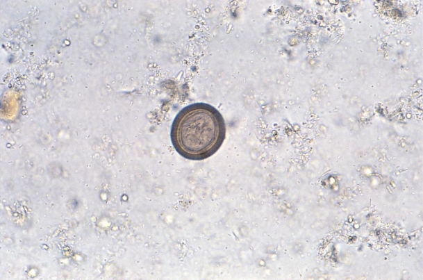 <strong>A 30-year-old male, who is a recent immigrant from Mexico, presents to a clinic saying he has long strands of what looks like cooked macaroni in his stool. A stool sample reveals the organism seen in the image provided. Source: CDC/Dr. Mae Melvin This individual is harboring</strong> A) Taenia solium. B) Taenia saginata. C) A parasite that requires review of a proglottid. D) A parasite that requires review of the scolex.