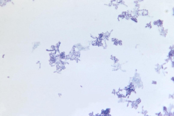 <strong>A 78-year-old male develops osteomyelitis after hip replacement surgery. After four weeks of antibiotics, he is sent home with two more weeks of intravenous antibiotics. On week 5, he develops a fever, and three sets of blood cultures are drawn. At 24 hours, the organism observed in the image provided was present in four of six bottles. Source: CDC and Dr. W. Kaplan The organism grows as a pinpoint haze on sheep blood and chocolate agars but not on MacConkey and reducible blood agars. Infection with this organism was probably due to</strong> A) antibiotic use. B) the presence of an artificial hip. C) a urinary catheter. D) the presence of an IV catheter.