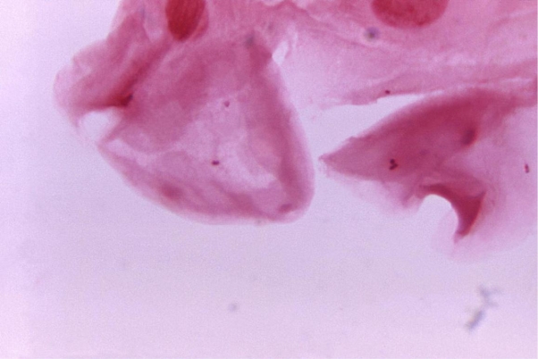 <strong>Review the image provided. The presence of this cell in an expectorated sputum indicates Source: CDC and James Volk</strong> A) an unacceptable specimen unless accompanied by the presence of white blood cells. B) an acceptable specimen if <10 per low power field are present. C) an acceptable specimen if <25 per high power field are present. D) an unacceptable specimen for Legionella spp. culture.