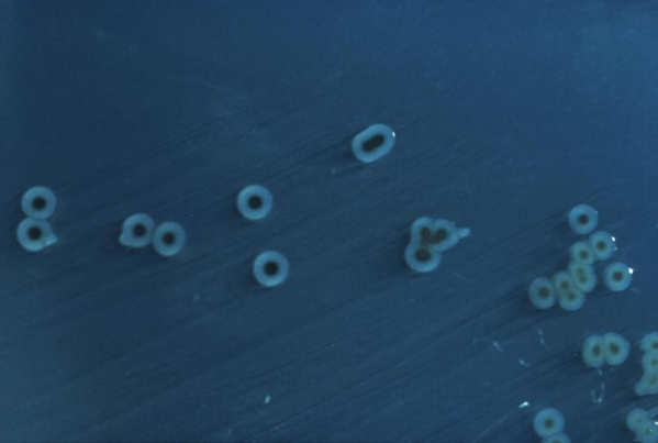<strong>A 4-year-old female develops diarrhea, and her mother takes her to the pediatrician. The child attends daycare five days a week while the mother works. The family had recently returned from a camping trip where the little girl spoke of catching turtles and lizards. An image of the HE agar plate of the child's stool culture is provided. Source: CDC Given this information , which of the following apply to this organism?</strong> A) a non-lactose fermenter. B) lysine decarboxylase negative. C) a swarming colony on blood agar. D) spot indole positive.