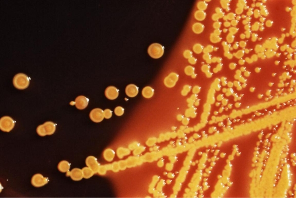 <strong>A stool culture was received from a 34-year-old male who is experiencing diarrhea after a family reunion picnic. The food served included hot dogs, hamburgers, fried chicken, potato salad, baked beans, and various desserts. The image provided shows the Hektoen-enteric agar growth from his culture. Source: CDC Based on these results, your next step in the workup of this stool culture is to</strong> A) perform testing to detect shiga toxin. B) disregard it as normal flora. C) perform Shigella serotyping. D) identify using saline as the inoculum suspension.