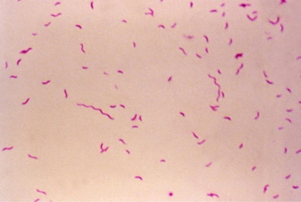<strong>A stool agar plate incubated at 42°C in an atmosphere of 5% O<sub>2</sub>, 10% CO<sub>2</sub>, and 85% N<sub>2</sub> grew as a tan colony that tends to follow the streak lines. An image of the Gram stain results of the colonies is provided. Source: CDC You would expect this organism to be</strong> A) oxidase positive. B) catalase positive. C) hippurate hydrolysis negative. D) a and b. E) all of the above.