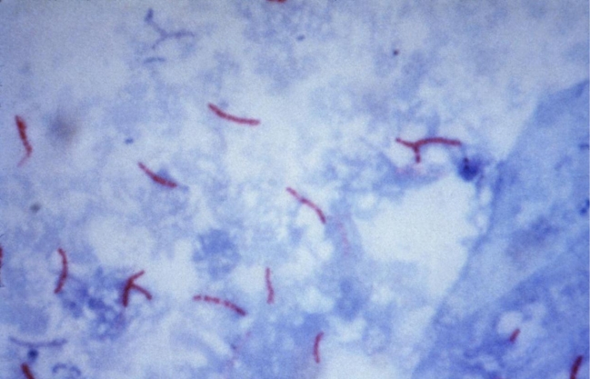 <strong>A sputum, submitted for AFB culture and smear, demonstrates the Kinyoun stain provided. Source: CDC and Dr. George P. Kubica The organism isolated on Lowenstein-Jensen agar provided the following reactions: Pigment: buff-colored colonies in the dark and yellow when exposed to light This organism is</strong> A) Mycobacterium gordonae. B) M. marium. C) M. kansasii. D) M. bovis.