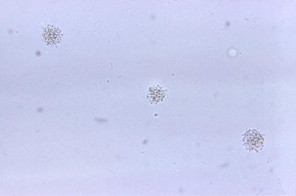 <strong>Given the colony on A-8 agar provided in the image, what was the original source of the specimen cultured? Source: CDC and Dr. Francis Forrester</strong> A) Sputum B) Blood C) Urine D) Amniotic fluid
