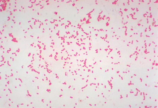 <strong>A patient in the intensive care unit has developed pneumonia. A sputum culture grows an oxidase-negative, non-lactose fermenter. The organism is demonstrated in the Gram stain below. The microbiologist works up the organism as a member of the Enterobacteriaceae. The next day she realizes her error. The organism displays the following results: Source: CDC and Dr. W. A. Clark TSI: K/NC Motility: negative OF medium: Open tubes: glucose: yellow, lactose: yellow, maltose: green Closed tubes: glucose: green, lactose: green, maltose: green</strong> A) Stenotrophomonas maltophilia. B) Acinetobacter baumannii. C) Moraxella lacunata. D) Pseudomonas fluorescens.