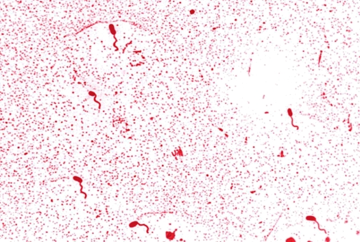 <strong>The flagellar arrangement of Vibrio cholerae, as seen in the image provided, can be described as Source: CDC and Dr. William A. Clark</strong> A) monotrichous. B) amphitrichous. C) lophotrichous. D) peritrichous.