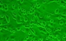 <strong>Using the image provided, determine the interpretation of the results of the cell culture. Source: Sreedharan Athmanathan, Sesha Reddy Bandlapally, and Gullapalli N. Rao.</strong> A) Uninoculated monolayer of cells B) Positive ELVIS test C) Cytopathic effect D) Plaque formation