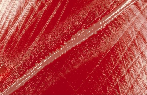 <strong>A positive blood culture displays gram-positive cocci in chains. A sample is plated to blood, chocolate, and MacConkey agars. After 24 hours incubation in CO<sub>2</sub> (BA, CA) and ambient air (MAC), all agar plates show no growth. An additional test was performed and the results are provided in the image provided. Based on these results, the organism is suspicious for Source: CDC and Dr. Mike Miller</strong> A) viridians Streptococcus. B) nutritionally variant Streptococcus. C) Aerococcus spp. D) Gemella spp.