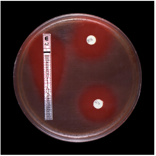 <strong>What is the MIC of the organism on the image provided?  </strong> A) Azithromycin-0.38 µg/mL B) Erythromycin-27 mm C) Tetracycline-30 µg/ml D) All results are qualitative, not quantitative. <div style=padding-top: 35px> 