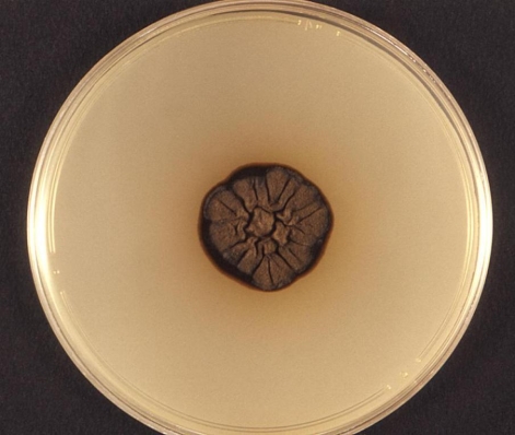 <strong>Using the image provided, this mould colony can be described as Source: CDC and Dr. Libero Ajello</strong> A) dematiaceous. B) hyaline. C) butyrous. D) mucoid.