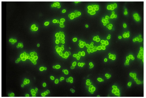 <strong>A pinpoint colony that is rapid trehalose assimilation positive and appears as the image provided can be presumptively identified as </strong> A) Cryptococcus neoformans. B) Candida tropicalis. C) C. albicans. D) C. glabrata.