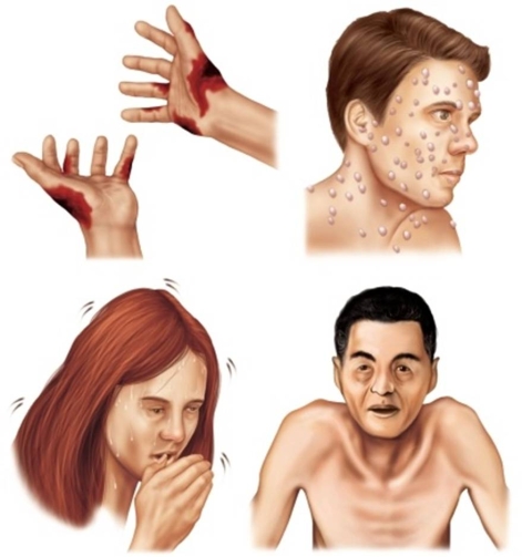 <strong>The four types of biological weapons, pictured here, are </strong> A) toxins, poisons, microbes, and viruses. B) fevers, rickettsia, prions, and bacteria. C) bacteria, viruses, rickettsia, and toxins. D) prions, fevers, microbes, and poisons.