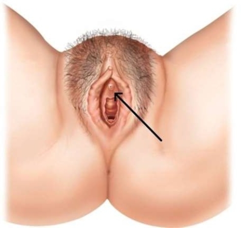 <strong>In this picture, the arrow is pointing to the </strong> A) vestibule. B) urethal opening. C) clitoris. D) labia minora.