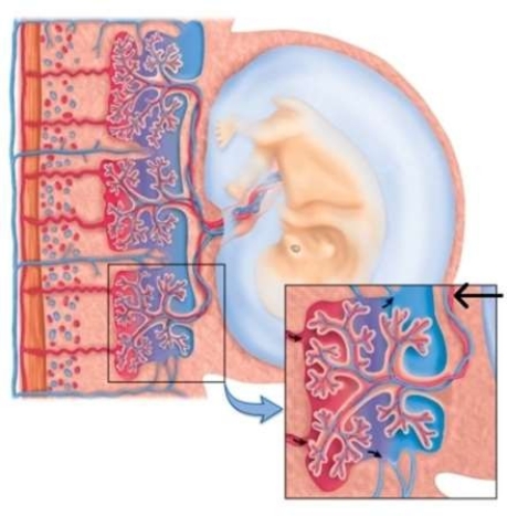 <strong>The larger black arrow in the right quadrant of the photo below is pointing to which part of the fetal portion of the placenta? </strong> A) Umbilical artery B) Umbilical venule C) Chorionic villus D) Fetal capillaries
