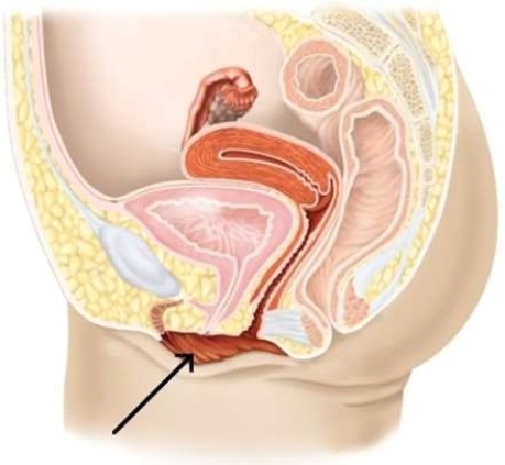 <strong>In the picture below, the arrow is pointing to the </strong> A) labia minora B) symphysis pubis. C) labia majora. D) clitoris.