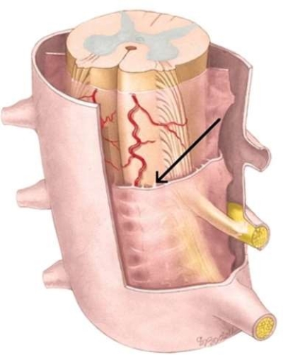<strong>What structure is identified in the following image? </strong> A) Subarachnoid space B) Arachnoid mater C) Subdural space D) Dural fold