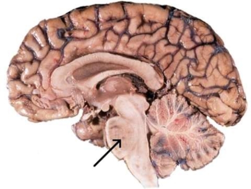 <strong>The portion of the brain, referred to in this image, which has an influence on respiration is the </strong> A) midbrain. B) medulla oblongata. C) pons. D) corpus callosum.
