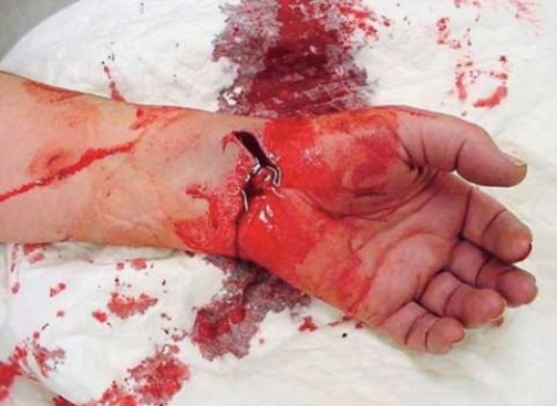 What type of injury is this?  