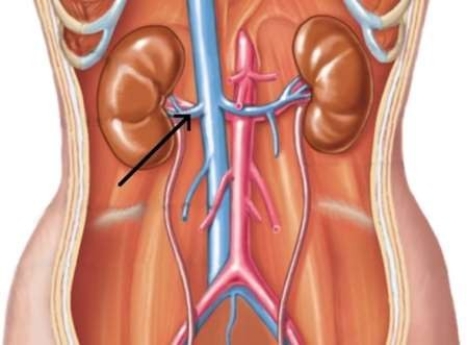 <strong>In the picture below, the arrow is pointing to the </strong> A) renal vein. B) aorta. C) inferior vena cava. D) renal artery.