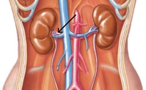 <strong>In the picture below, the arrow is pointing to the </strong> A) inferior vena cava. B) aorta. C) renal artery. D) renal vein.