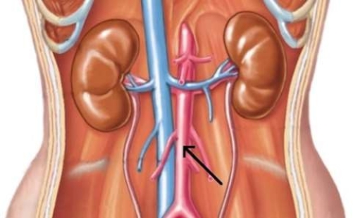 <strong>In this picture, the arrow is pointing to the </strong> A) inferior vena cava. B) renal artery. C) renal vein. D) descending aorta.