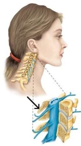 <strong>The arrow is pointing to the part of the vertebra on the posterior side of the body, which is called the</strong> A) body. B) spinal cord. C) disk. D) spinous process.